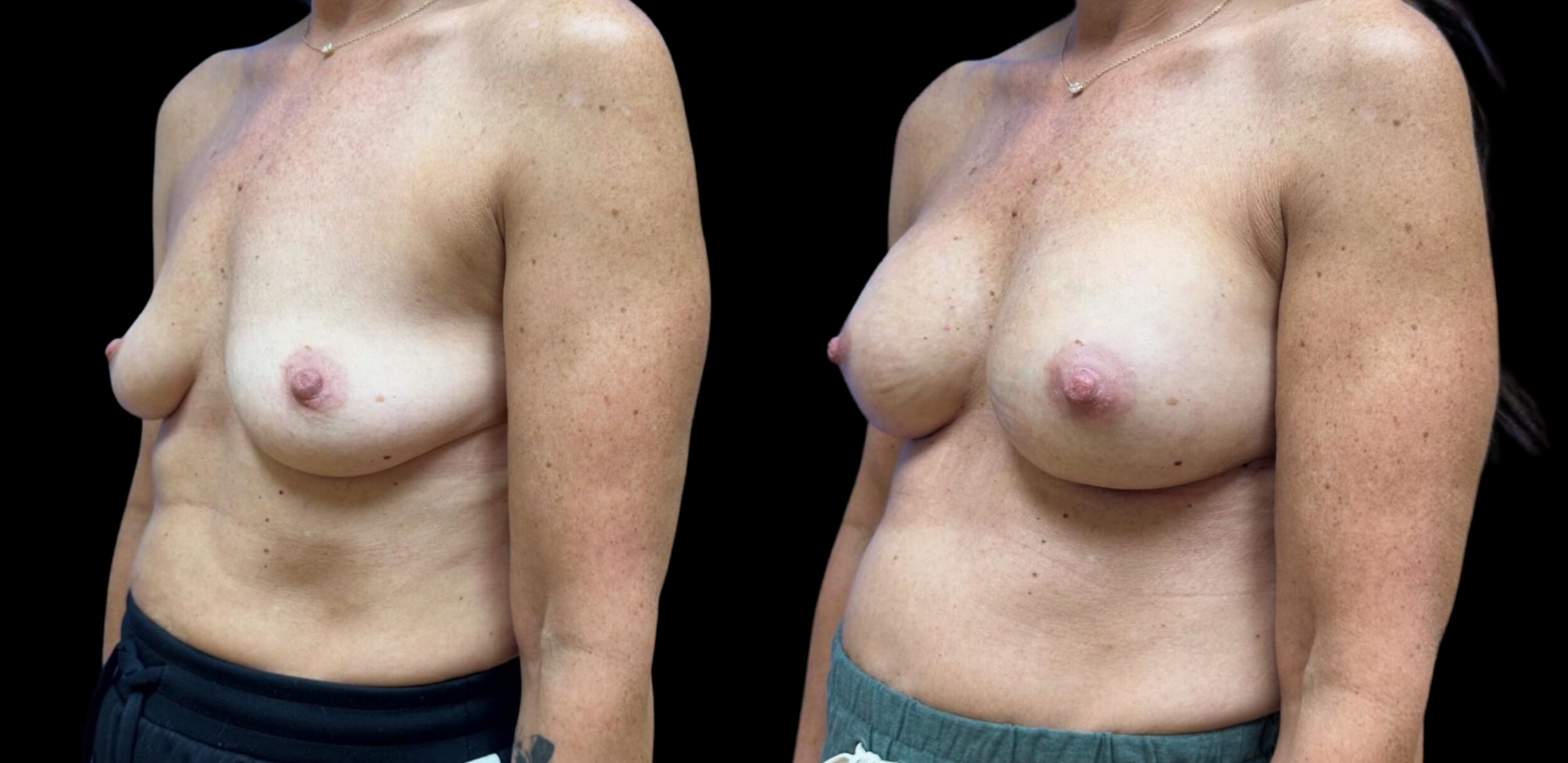 Before and After Image: Preserve by Motiva - left-front-oblique