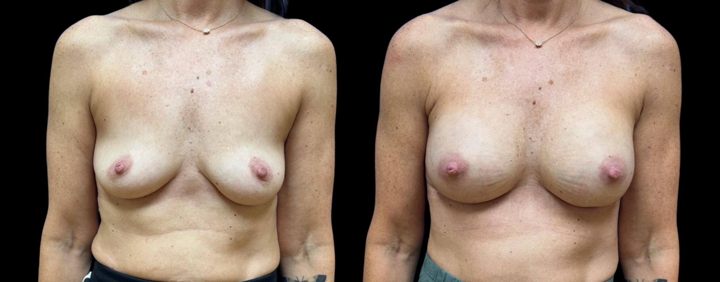 Before and After Image: Preserve by Motiva - front