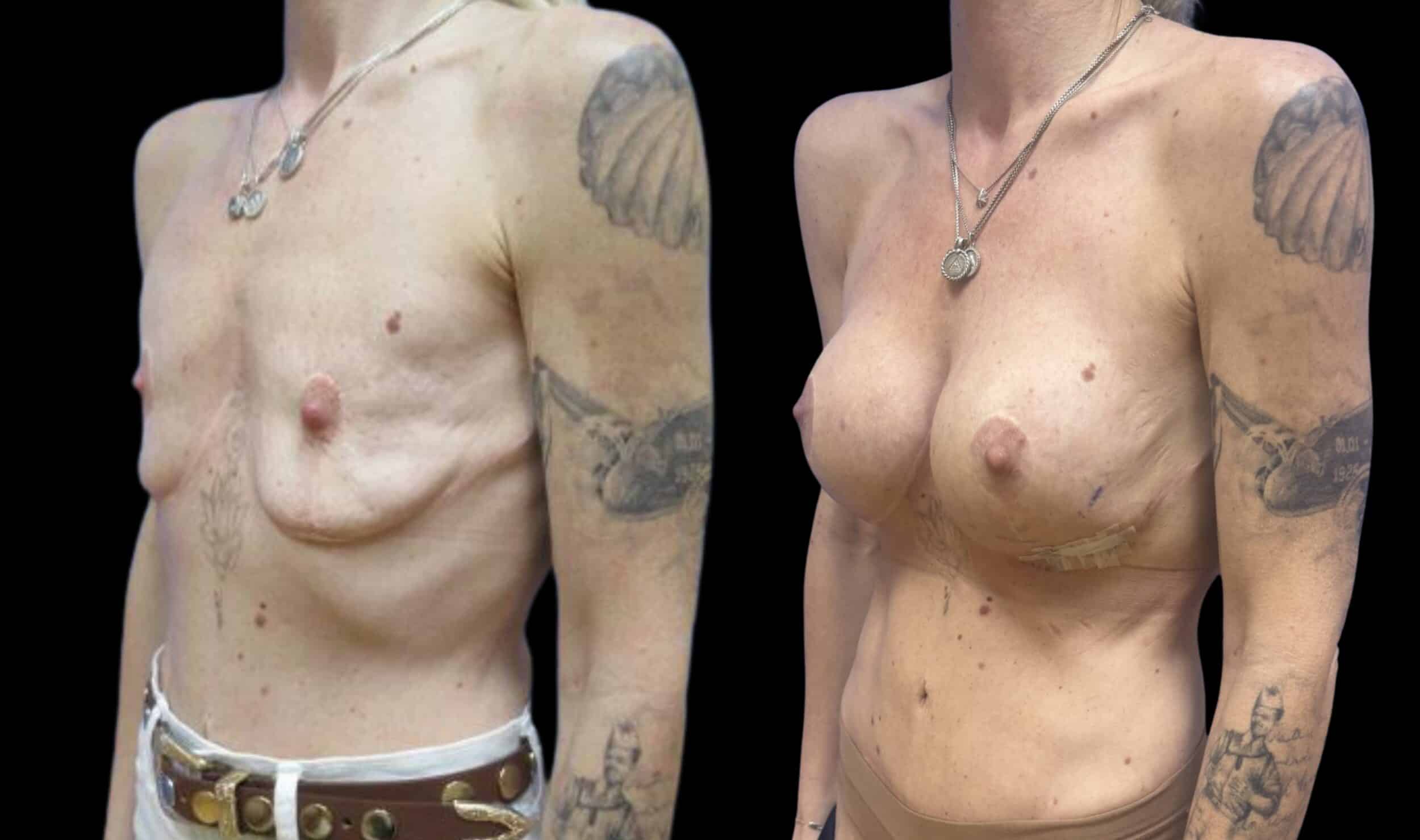 Before and After Image: Preserve by Motiva - left-front-oblique