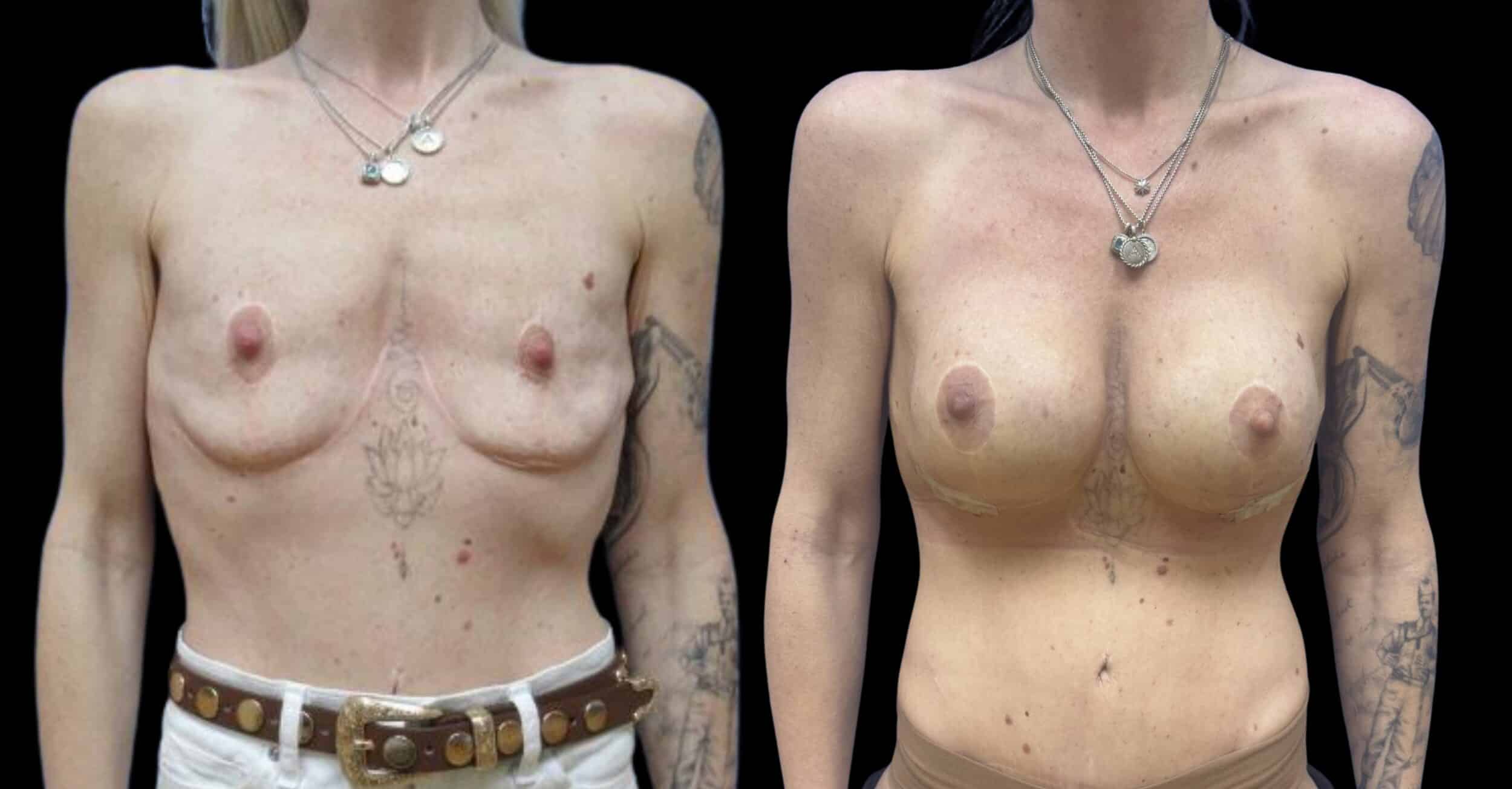 Before and After Image: Preserve by Motiva - front
