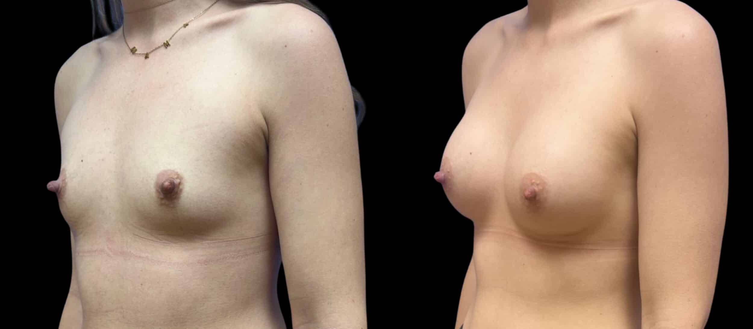 Before and After Image: Preserve by Motiva - left-front-oblique